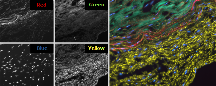 4 Color Blend Example